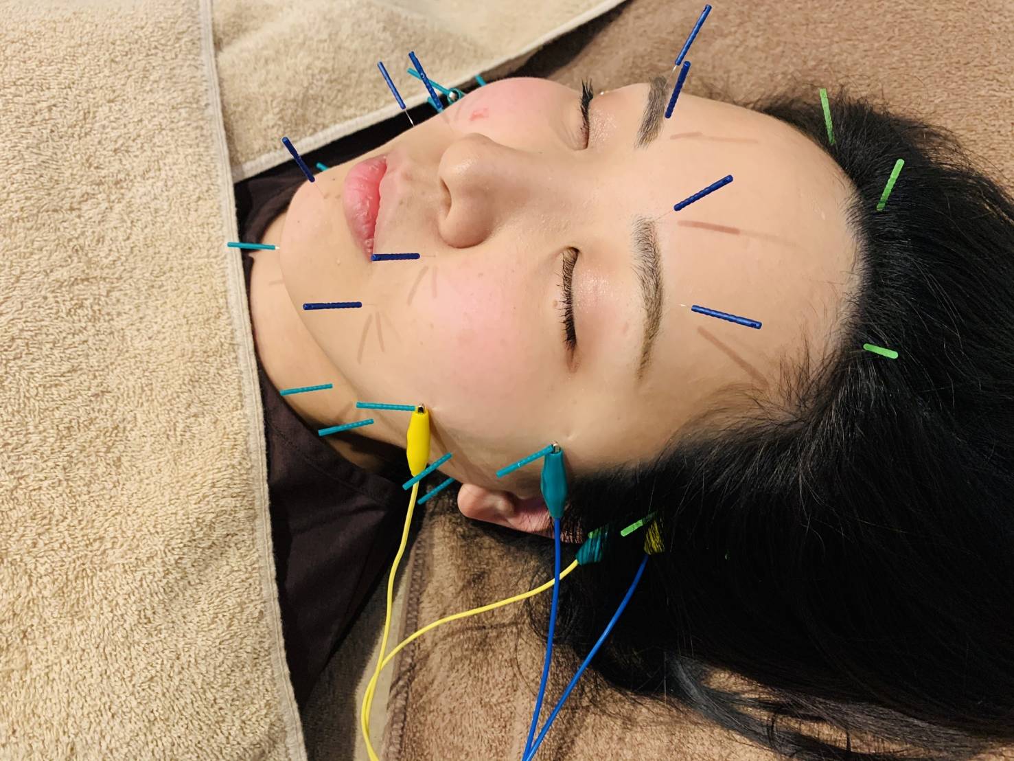美容鍼灸サロン