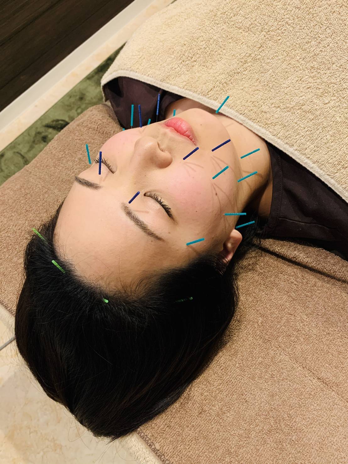 美容鍼灸サロン