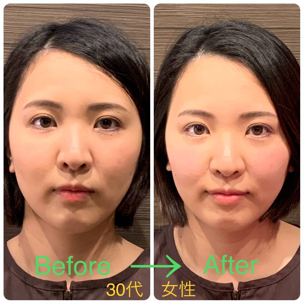美容鍼灸サロン